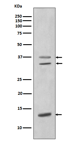 CEBP beta Ab