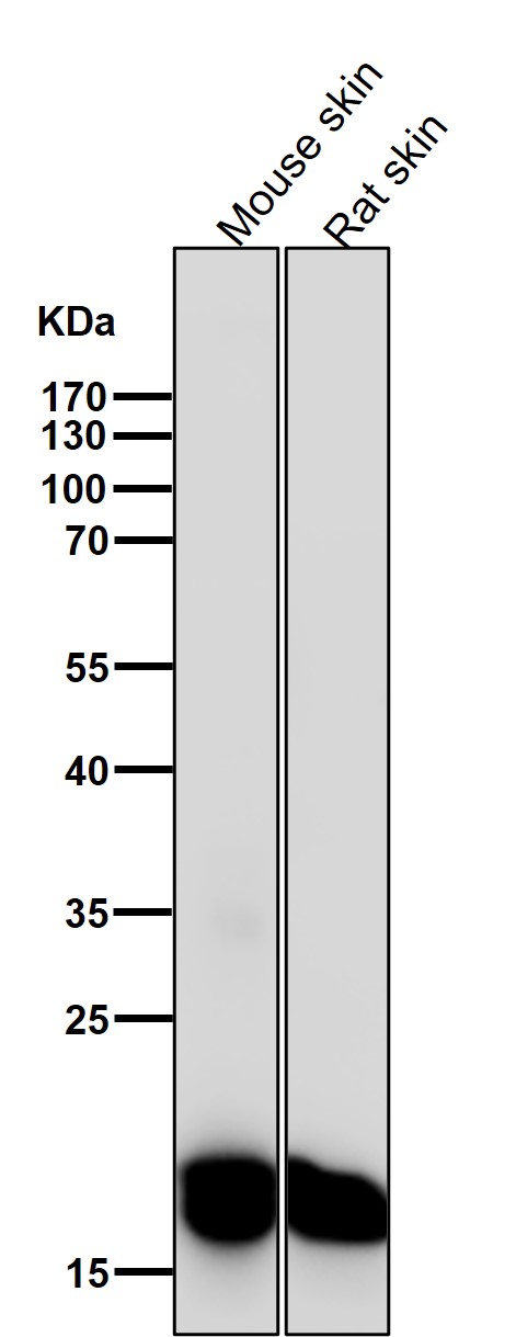 CEBP beta Ab