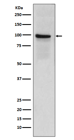 Thrombomodulin Ab