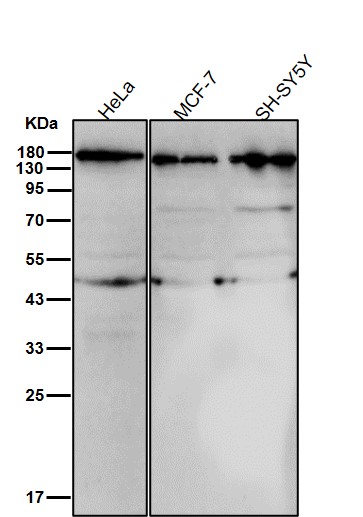 DAP kinase 1 Ab