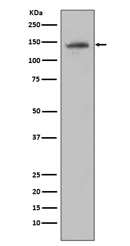 CD22 Ab