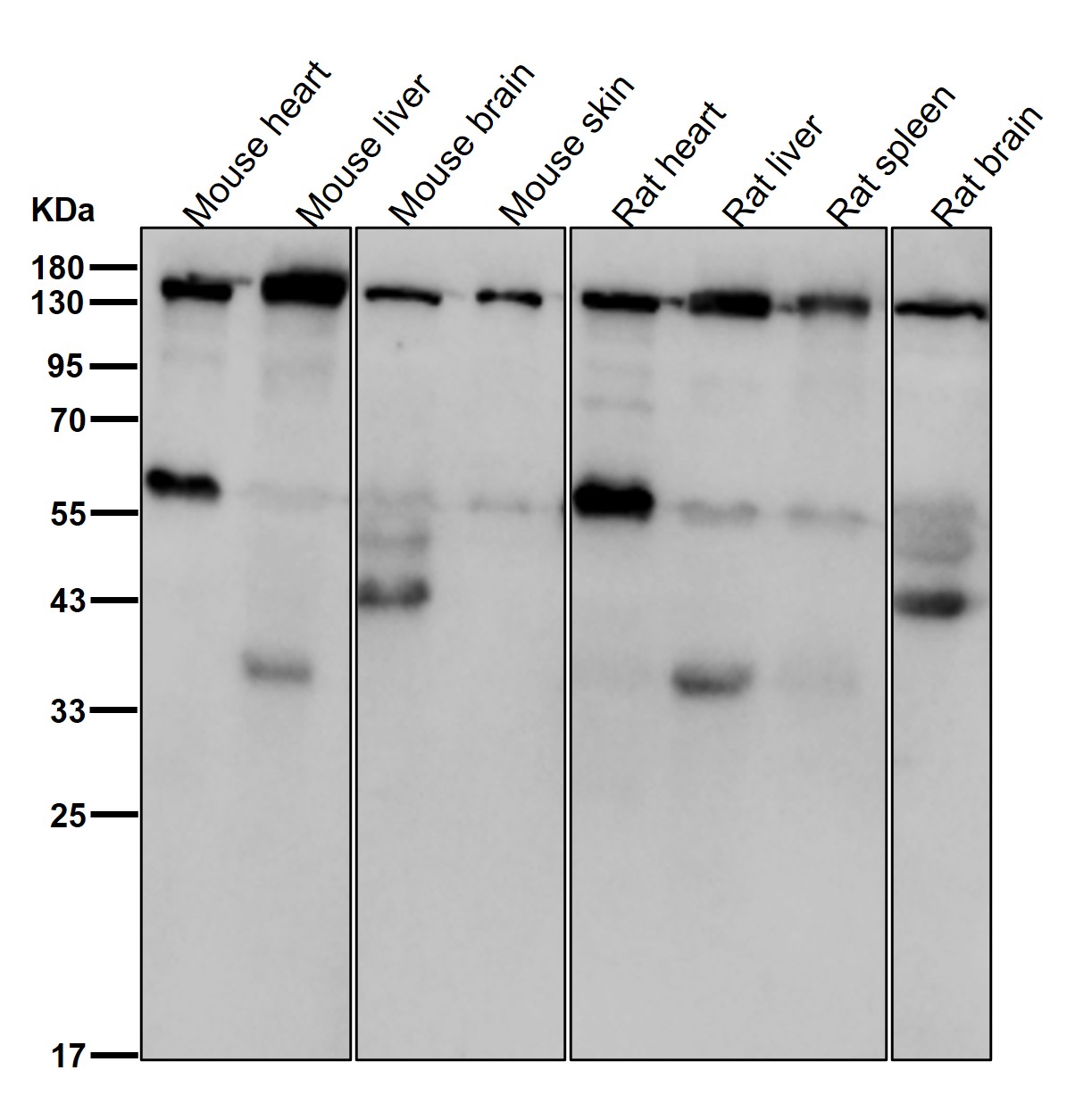 CD22 Ab