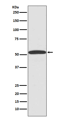 beta Arrestin 1 Ab