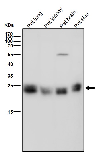 Integrin alpha V Ab