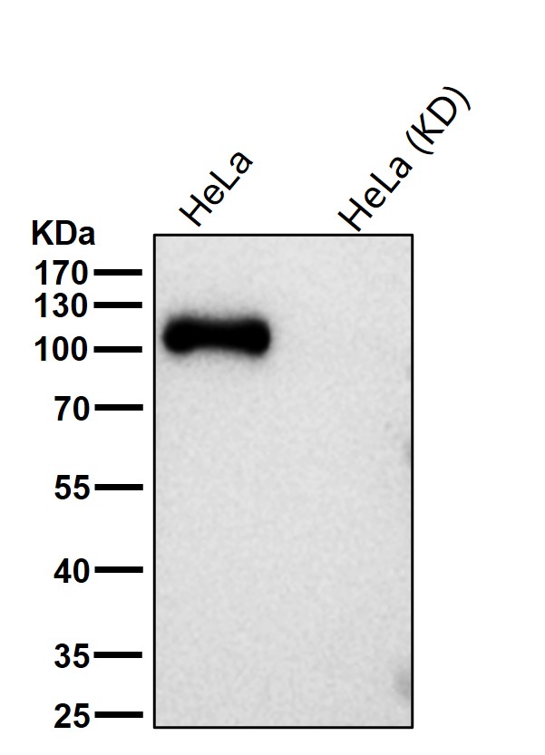 Androgen receptor Ab