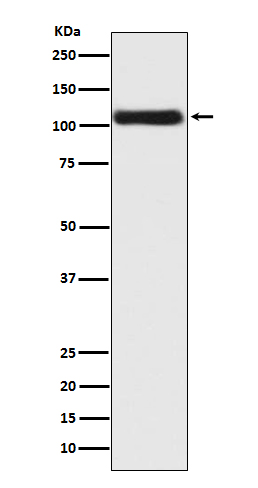 Androgen receptor Ab