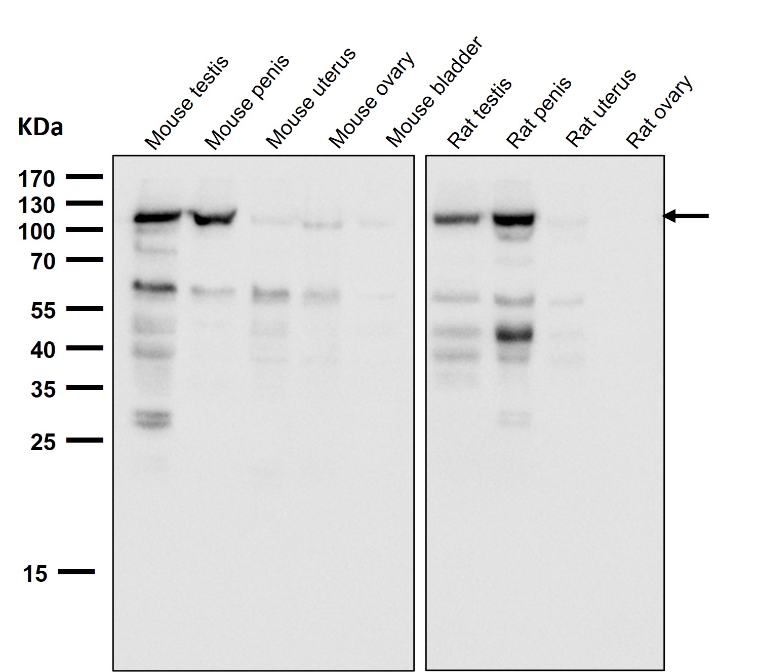 Androgen receptor Ab