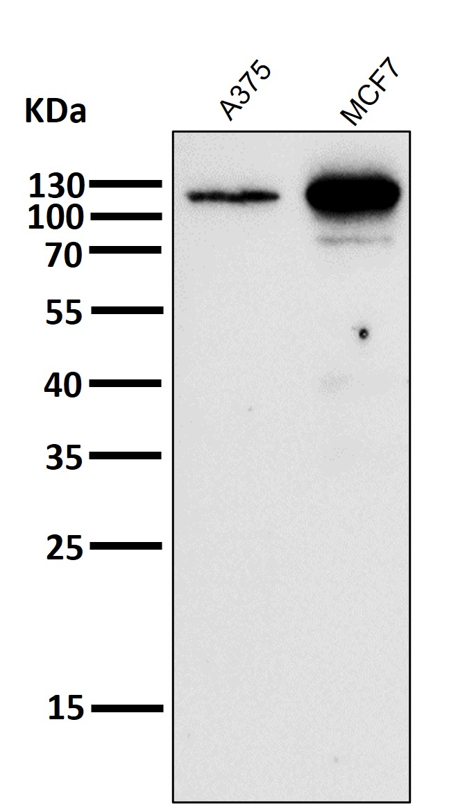 Androgen receptor Ab