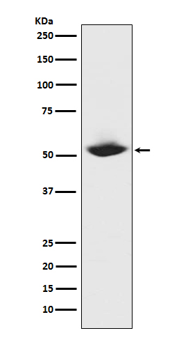 MMP1 Ab