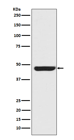 Cytokeratin 20 Ab