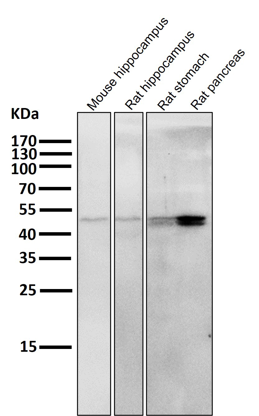 Cytokeratin 20 Ab