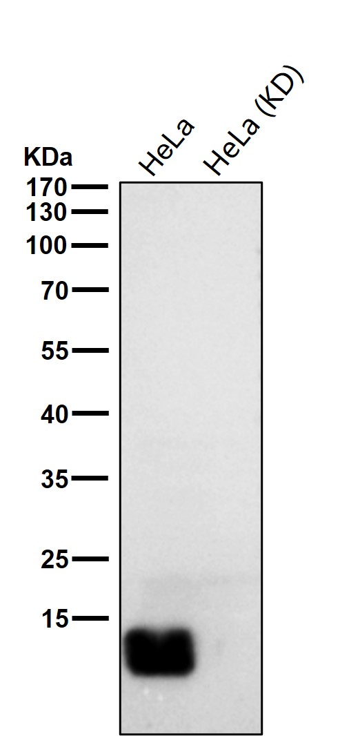 beta 2 Microglobulin Ab