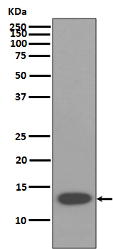 beta 2 Microglobulin Ab