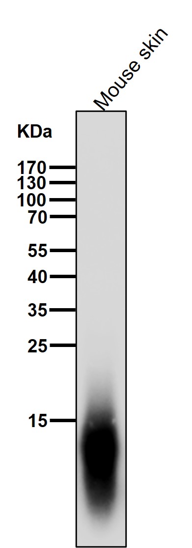 beta 2 Microglobulin Ab