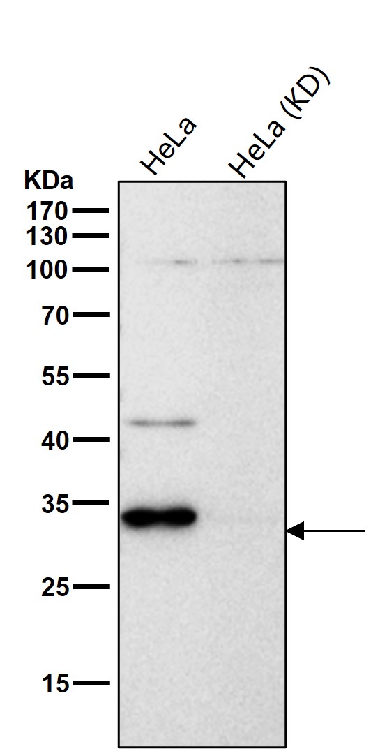 Cathepsin D Ab