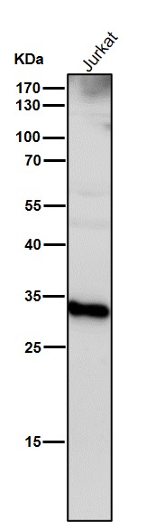 Cathepsin D Ab