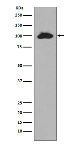 STAT6 Ab