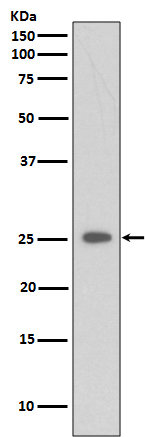 C reactive protein Ab