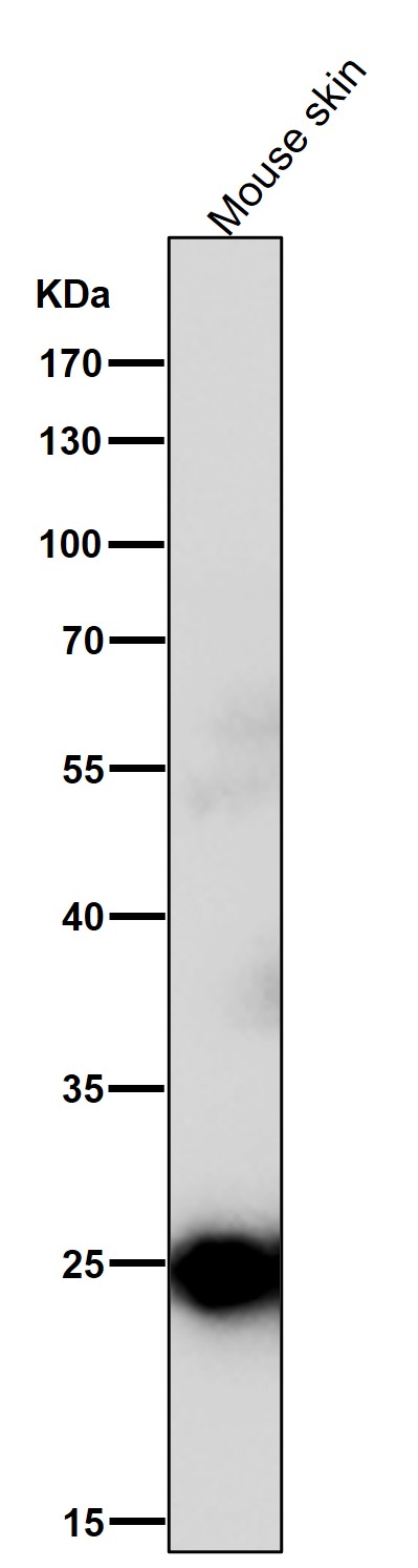 C reactive protein Ab