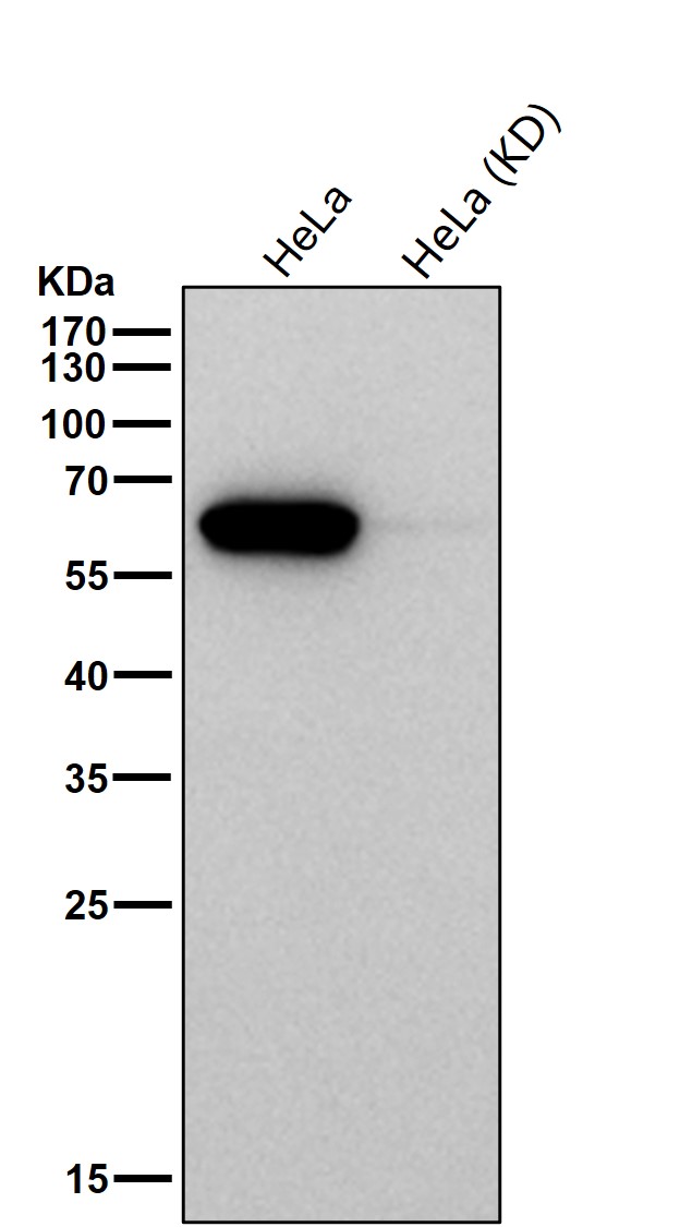 Calreticulin Ab