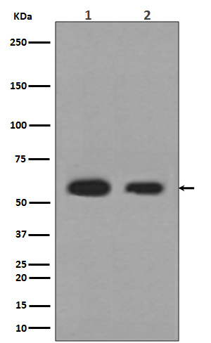 Calreticulin Ab