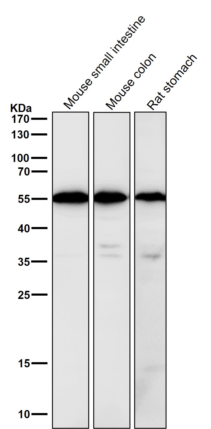 Calreticulin Ab