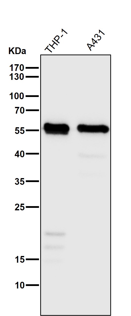 Calreticulin Ab