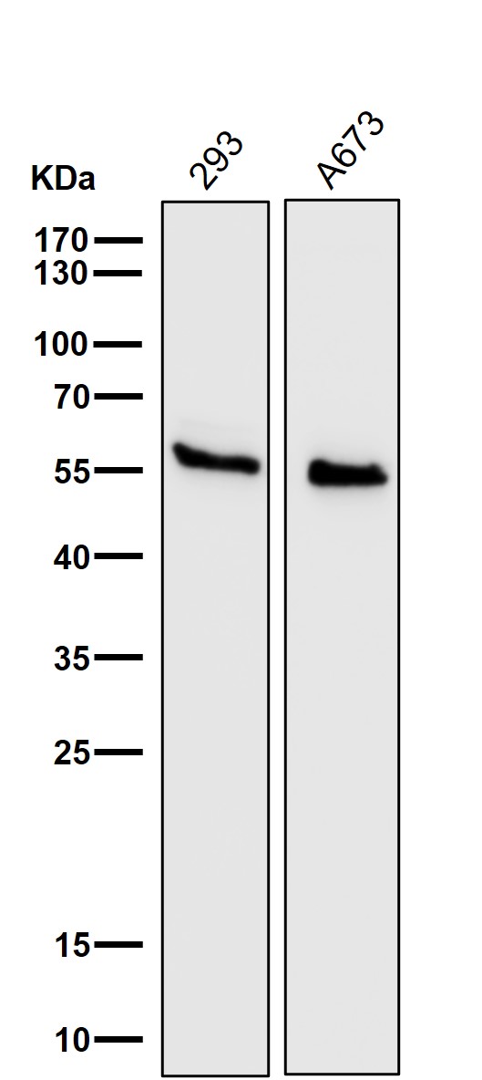 Calreticulin Ab