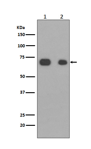 Caldesmon Ab