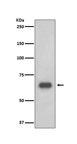 p70 S6 Kinase Ab