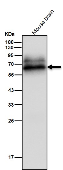 p70 S6 Kinase Ab