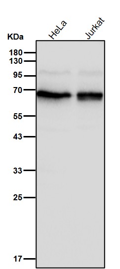 p70 S6 Kinase Ab