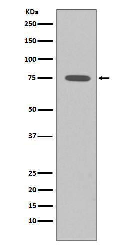 SSTR2 Ab