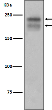 VEGF Receptor 2 Ab