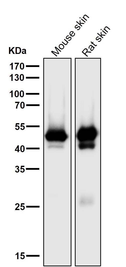 Cytokeratin 15 Ab