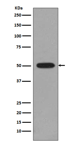 beta 4B/2A/2B Tubulin Ab