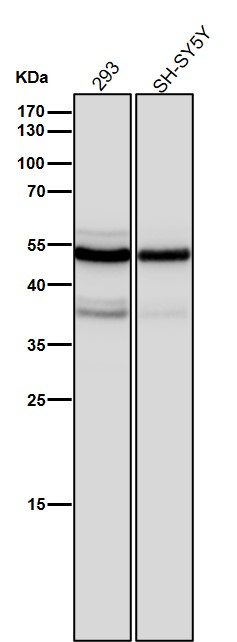 beta 4B/2A/2B Tubulin Ab