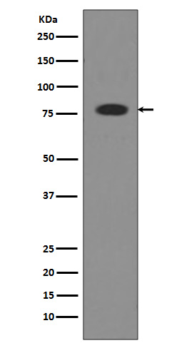 Transferrin Ab