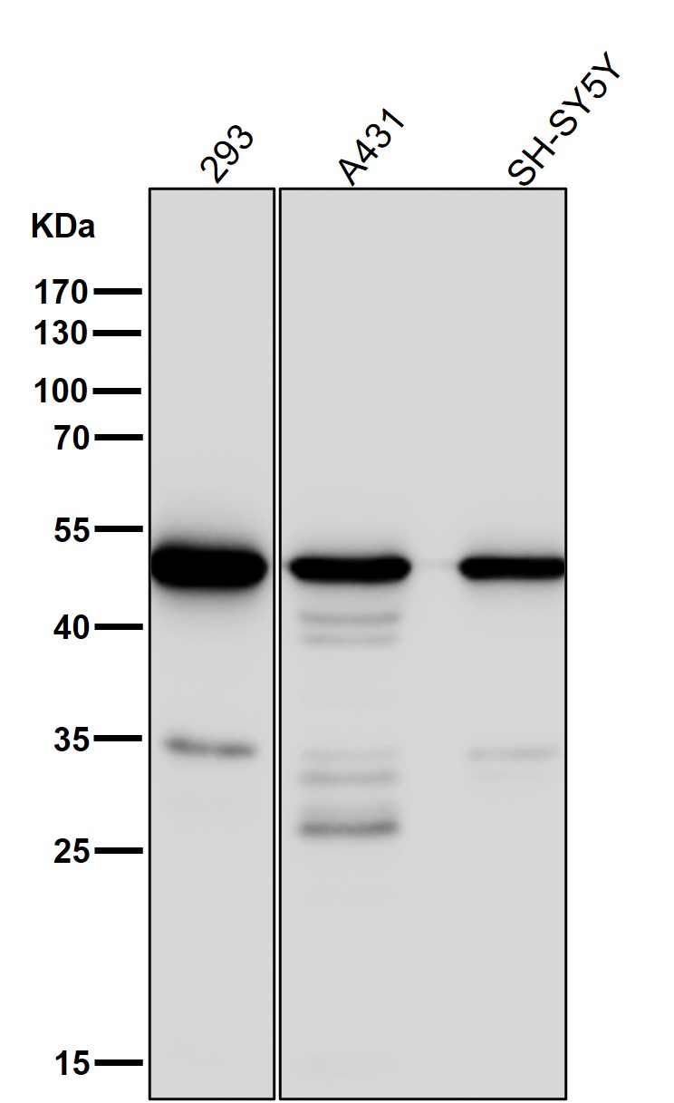 gamma 1 Tubulin Ab