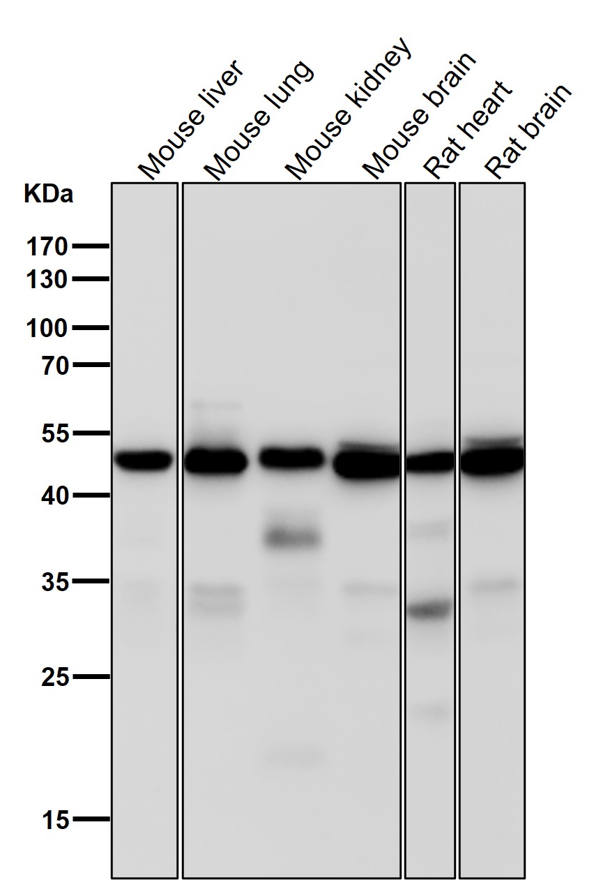 gamma 1 Tubulin Ab