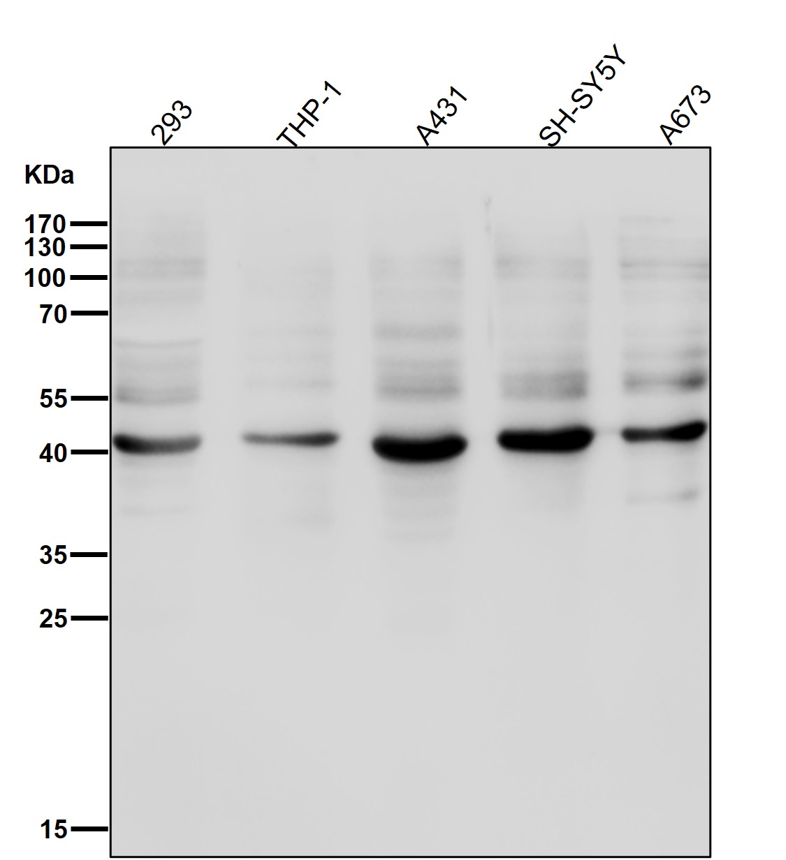 Caspase 1 Ab