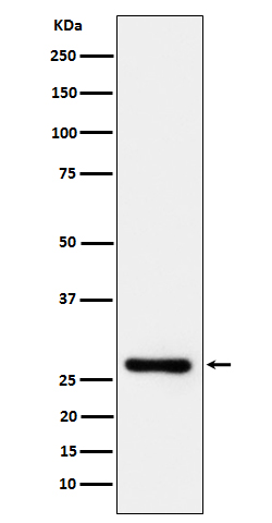 DcR1 Ab