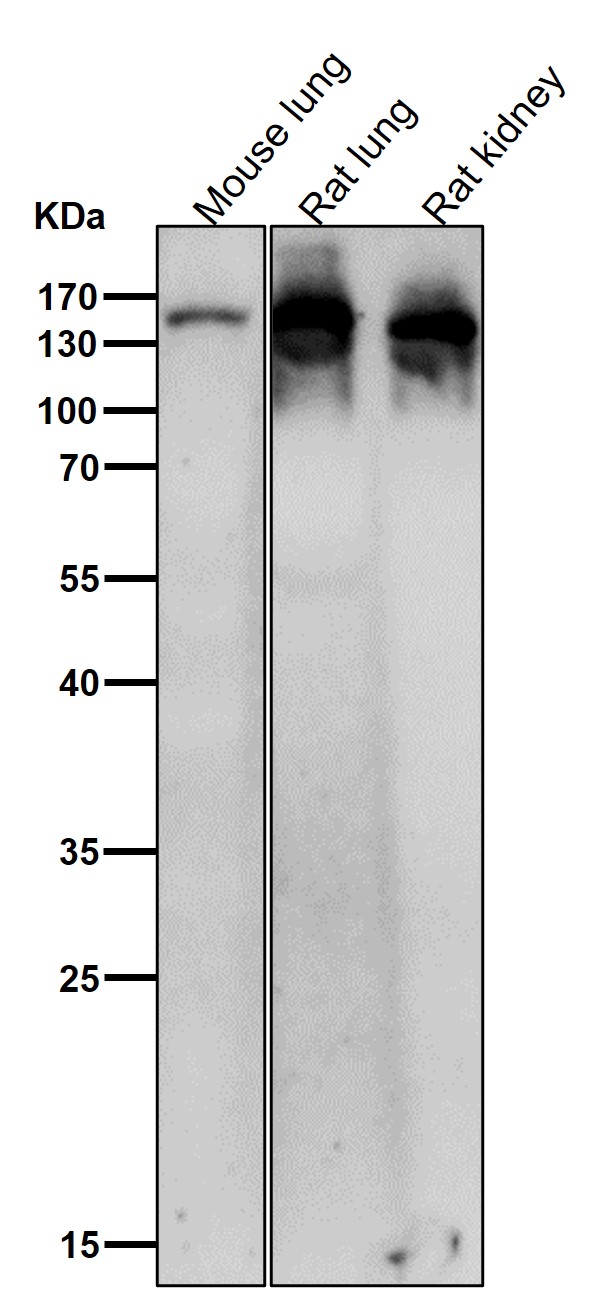 Ceruloplasmin Ab