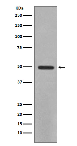 YBX1 Ab