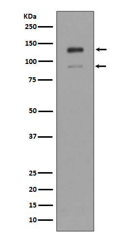 IFN alpha/beta receptor 1 Ab