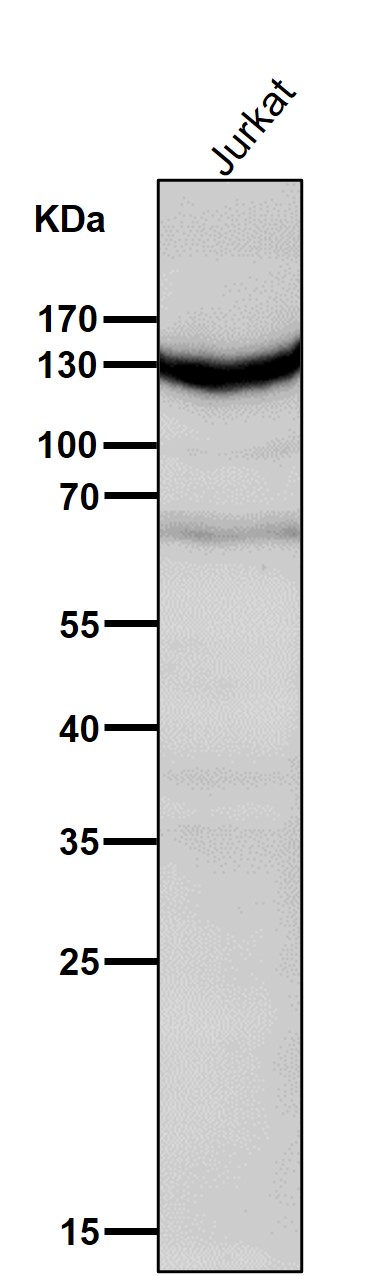 IFN alpha/beta receptor 1 Ab