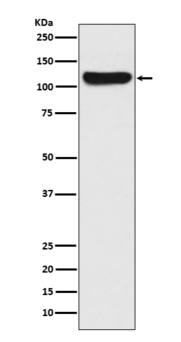 Focal adhesion kinase 1 Ab