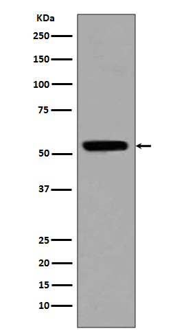 Acetyl-p53 (K370) Ab