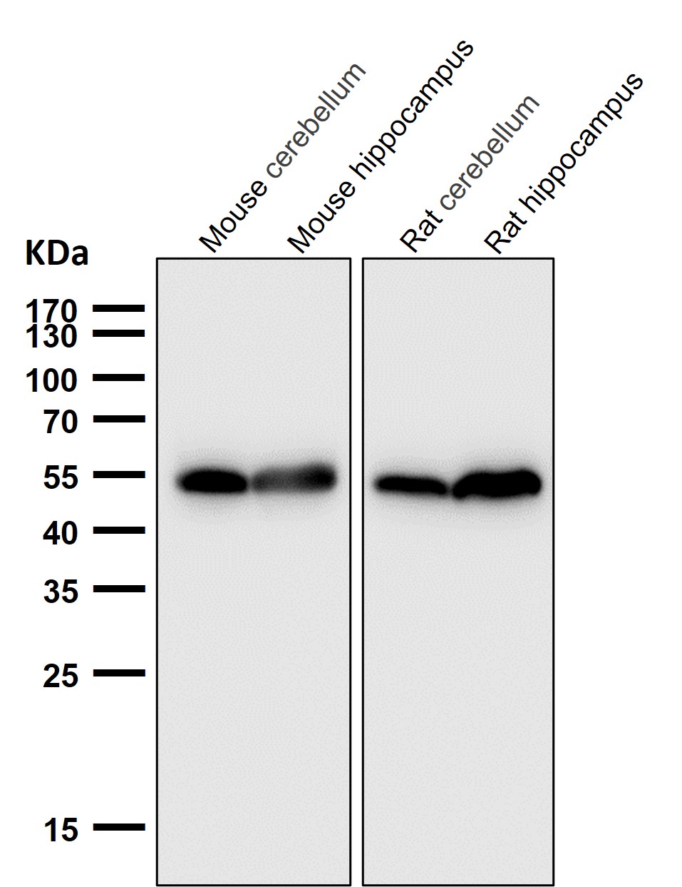 Acetyl-p53 (K370) Ab