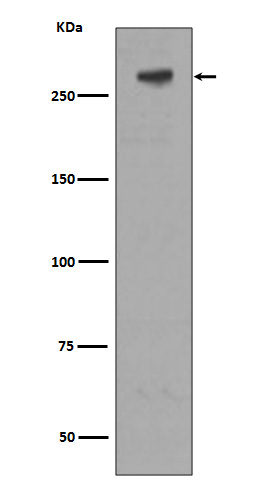 IGF2R Ab